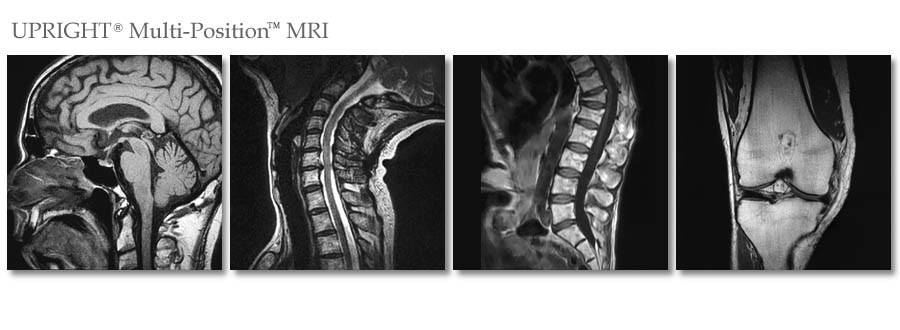 Stand-Up MRI of Great Neck, NY